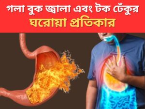 Read more about the article গলা বুক জ্বালা ও টক ঢেঁকুর: কারণ, প্রভাব ও সমাধান