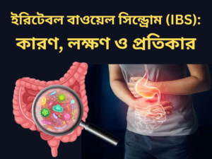 Read more about the article ইরিটেবল বাওয়েল সিন্ড্রোম (IBS): কারণ, লক্ষণ ও প্রতিকার