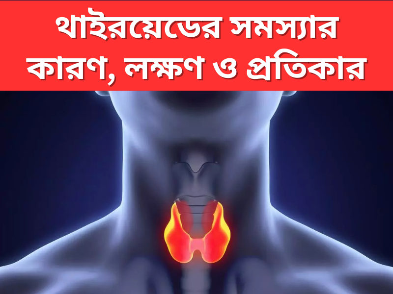 thyroid-somossa-karon-lakshan-o-pratikar