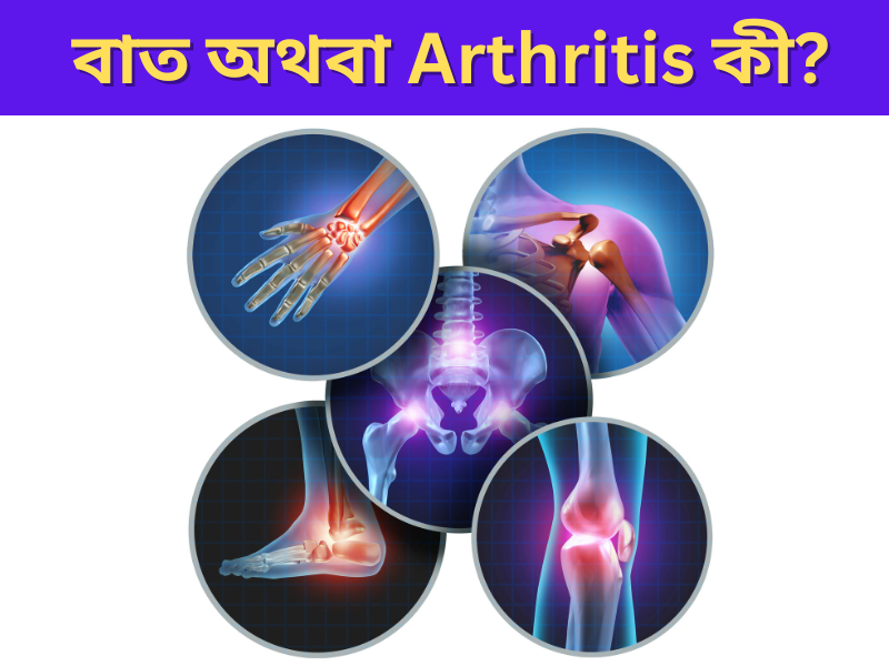 বাত অথবা Arthritis কী